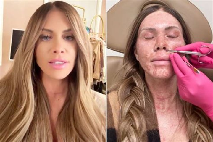 'Teen Mom' Star Regrets Cosmetic Surgery!