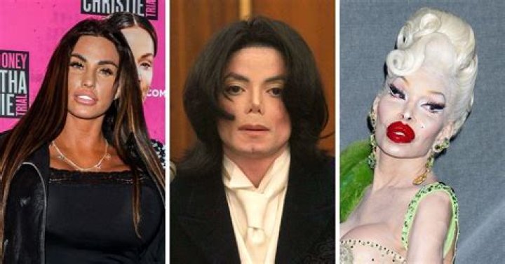 10 Cosmetic Surgeries Celebrities Request the Most