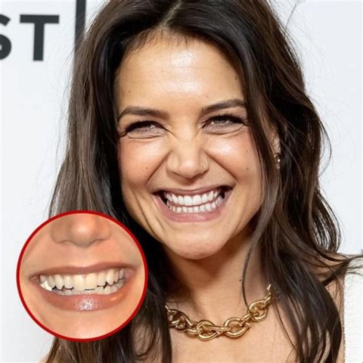 20 Celebrities Who Completely Own Their Bad Teeth