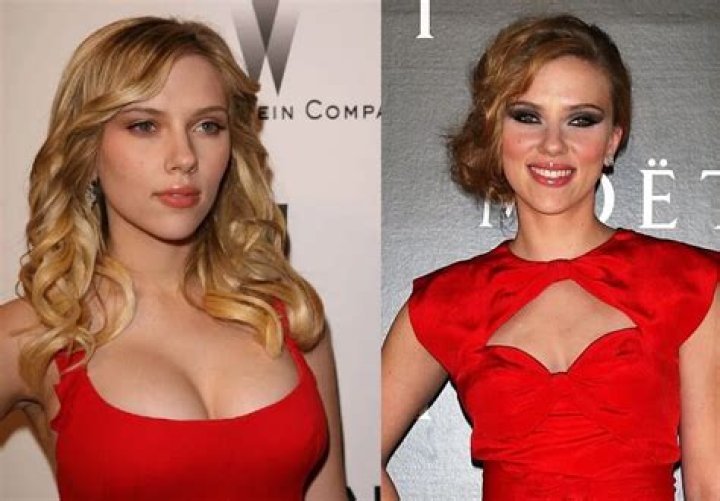 Did Scarlett Johansson Go Under The Knife For Breast Reduction?
