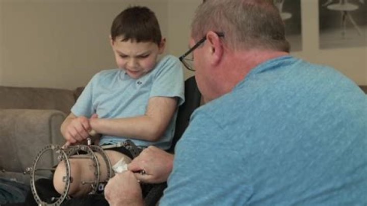 How Did Tony Hudgell Lose His Legs? Walking Stick, Mother Abuse