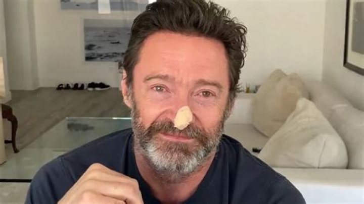 Hugh Jackman Reveals a Skin Cancer Scare