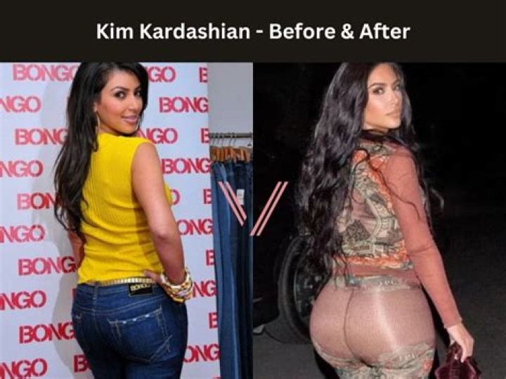 Kim Kardashian Speaks Out on Plastic Surgery
