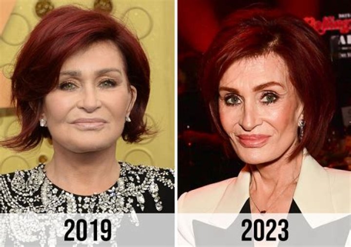 Sharon Osbourne's latest facelift was the 'worst thing she ever did'