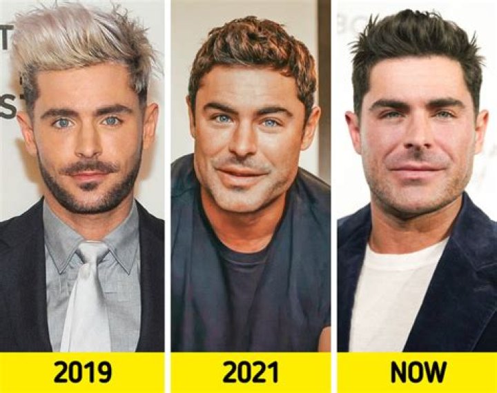 Zac Efron almost died after accident at home knocked him out completely